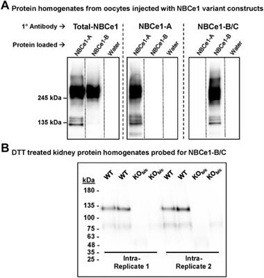 NBCe1-B/C-knockout mice exhibit an impaired respiratory response and an enhanced renal response to metabolic acidosis